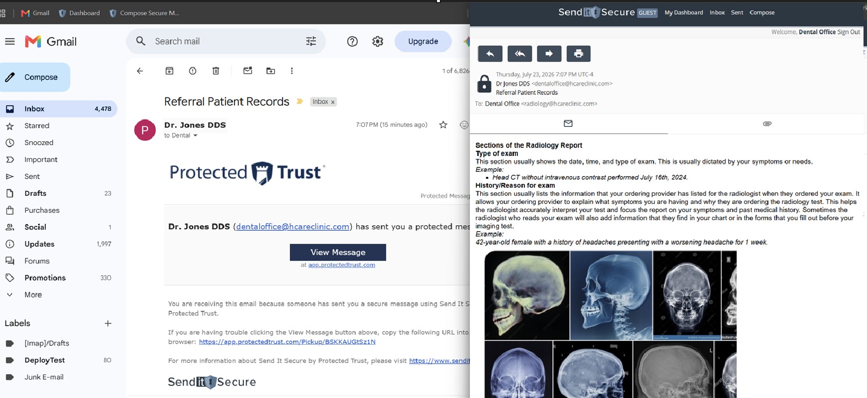 A Send It Secure notification in Gmail with the View Message button, and the secure message opened in a second browser tab